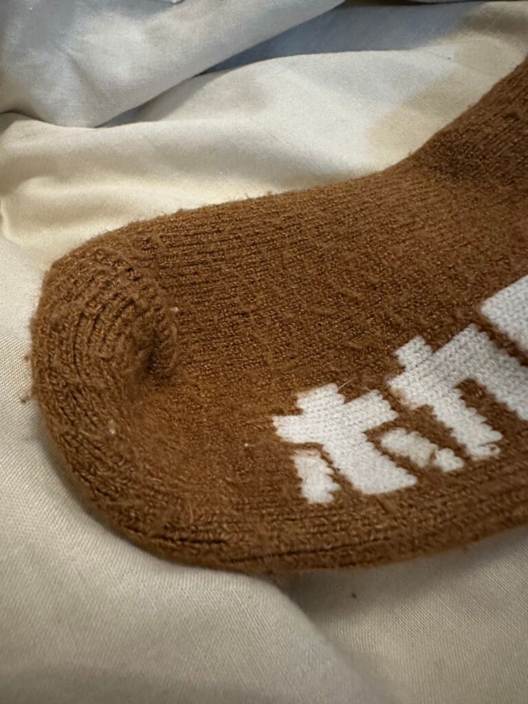 履くホカロン靴下を履き続けて毛玉ができた部分の写真